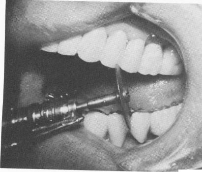 2 Histology shows regular cell arrangement near vent plant implant site
