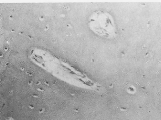 1 Soft tissue near vent plant implant site shows many islands of bone