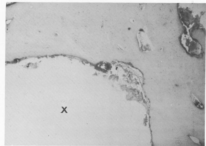 2 Bone follows the shape of the vent plant implant site