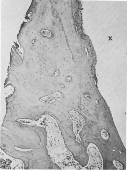 2 Dense fibrous tissues at vent plant implant site bound to healthy bone