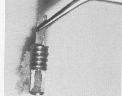 4 Broken vent-plant implant eight months after insertion in nasal septum