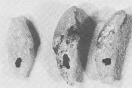 2 Well defined bony bridge growth through hole in crystalline implant