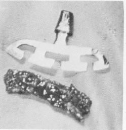 5 Endosseous blade implant inserted lingual to original implant site