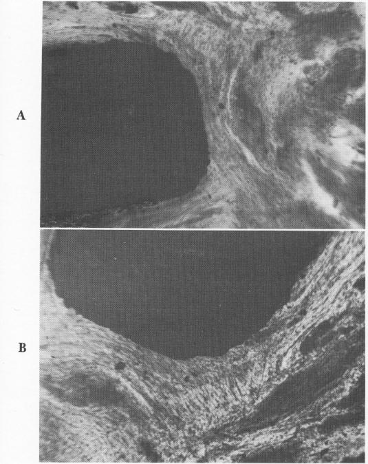 1 Soft tissues oriented around tantalum subperiosteal implant post