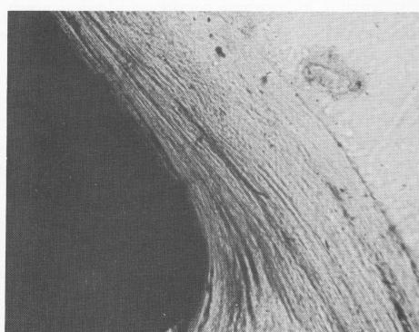 2 Tantalum subperiosteal implant post with highly organized fibers