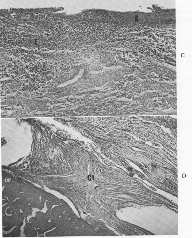 1 Nature of epithelial and inflammatory cells near subperiosteal implant site