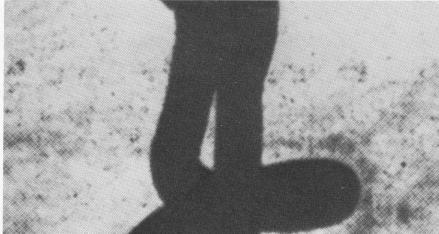 1 Formiggini endosseous implant with bone regrowth in base