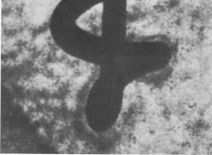 2 Extracted Formiggini implant with bone growth around base