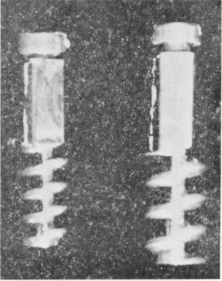 1 Coil, or spring endosseous implant designs of Trattner, Lew and Linkow