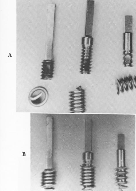 2 Coils of endosseous implants with posts in place