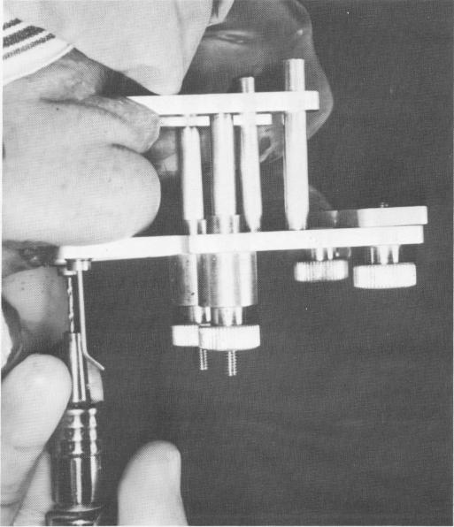 2 Christensen`s jig used for endosseous implant transfixation screw site