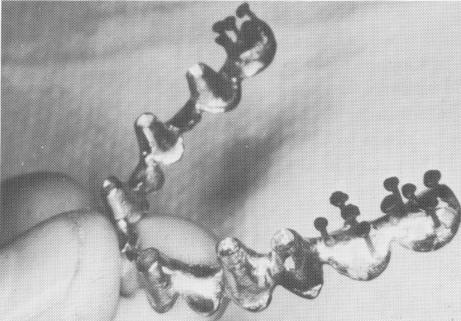 1 Triplant and vent plant endosseous implants in full arch template