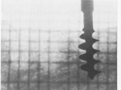2 Xray grid for calculation of bone depth near implants