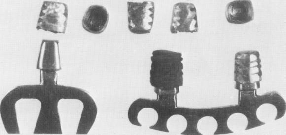 2 Various endosseous implant blades and their copings