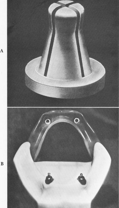 1 Ceka implant attachment and its utilization in mandible