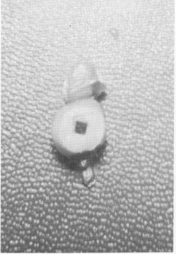 4 Upper implant post extends from fibromucosa in posterior area