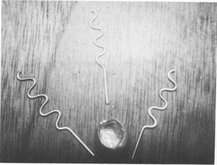 3 Prefabricated acrylic-fused-to-gold thimble crown is seen.