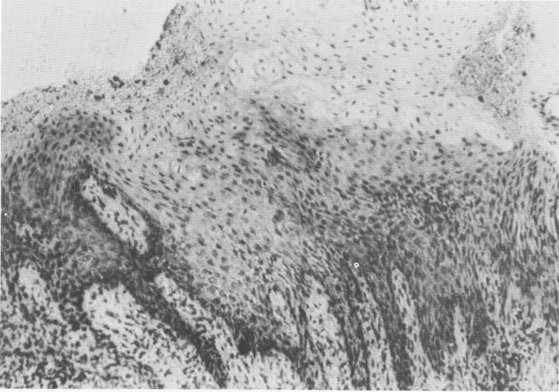 1 Superficial epithelium and malpighian bodies at Formiggini implant site
