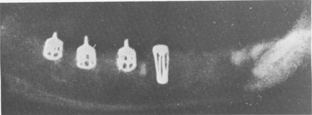 1 Pasqualini implant designs experimentally placed in dogs` jaws