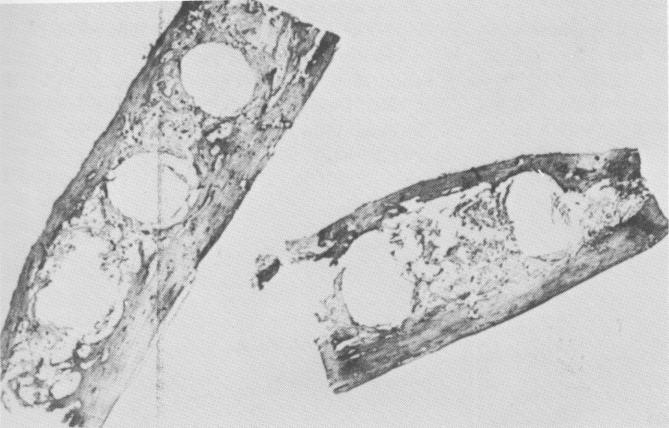 1 Dog mandible histologic view with bone growth near Pasqualini implant 