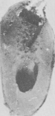 2 Bone growth into large cores of Pasqualini implant in dog mandible