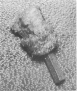 1 Clinical view of Chercheve endosseous spiral-post tuberosity implant