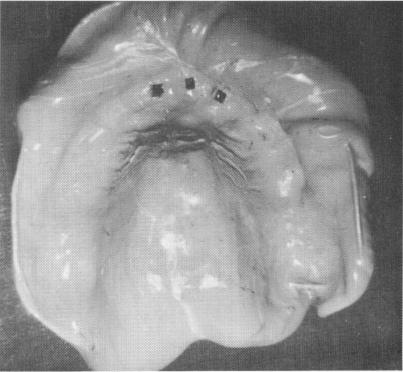 2 Full arch rubber base impression of upper jaw taken