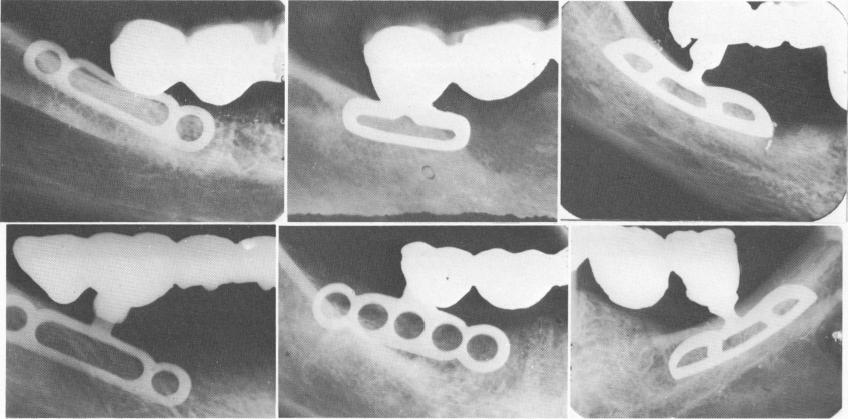 1 Various dental blades for shallow areas in upper and lower jaws