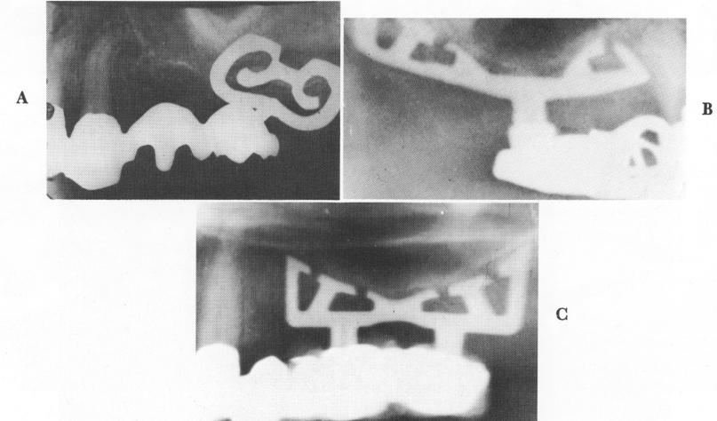 2 Exposed mandibular bone with groove made for blade implants