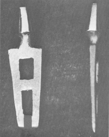 1 Facial and profile view of single tooth blade implant