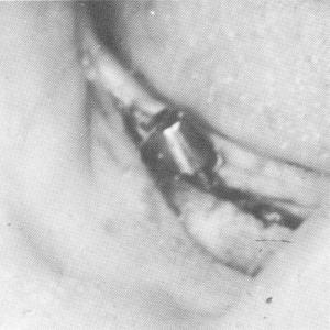 3 Malpositioned and poorly occluded teeth