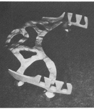 1 Palatal horseshoe type blade insertion in maxilla