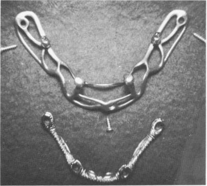 1 Substructure of subperiosteal dental implant with small set screws