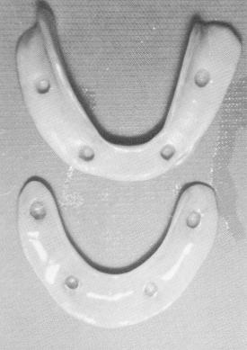 3 Completed implant denture is much smaller than temporary denture 