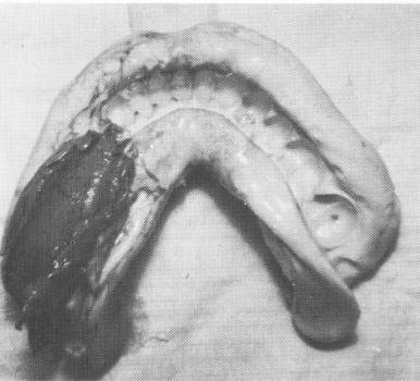 1 Lingual notches in jaw are half to one mm deep, & one & half mm wide