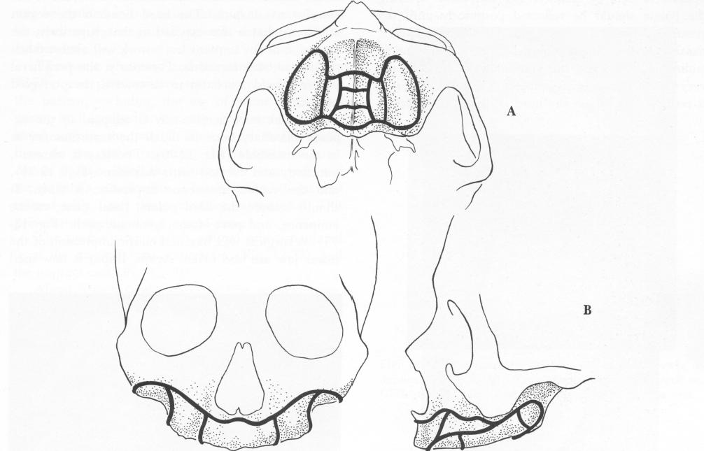 1 Peripheral border extensions of subperiosteal maxillary implant