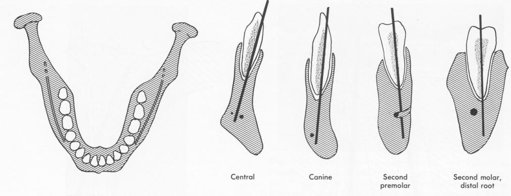 1 In mandible, root axes extension bypass mandibular canal in most cases