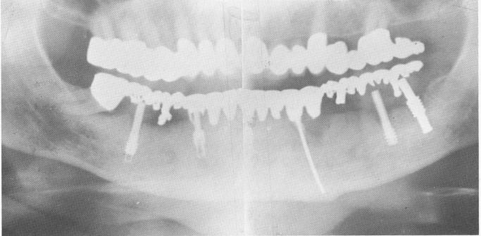 3 Mouth of 55 year old physician