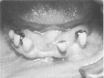 2 View of remaining teeth in mandible